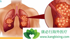 �����ڷΰ����߶����������Ԥ���ΰ�����