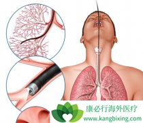 ����Щ��Ч�ķ�������Ԥ���ΰ�����