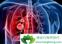 �������ƺ��Сϸ���ΰ������ڴ�Լ��5��