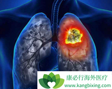 ��β�����Ч�ӳ�Сϸ���ΰ�������