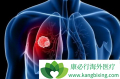 ��������ƥ����������ɼ�����Ʒΰ�Ч����ô��