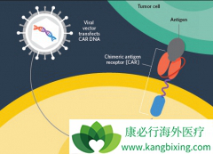 CAR-Tϸ����ͨ������ת�Ƽ�����������ѪT�ܰ�ϸ��������