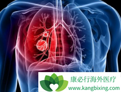 ���ڵķΰ���ת��֢״����Щ