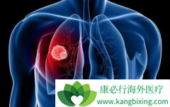 PD-1�������Ƽ�������Ϊ������ѡ�ķΰ������Ʒ���