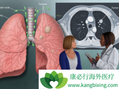 �ڼ���֮��ΰ����ڻᴫȾ��