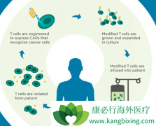 CAR-Tϸ��������ָǶ�Ͽ�ԭ����Tϸ�������Ʒ�