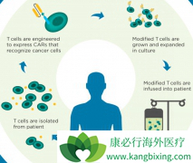 �����������д���ǰ����CAR-T�Ʒ���ʲô?