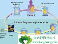 ŵ����CAR-T��ƷKYMRIAHΪ�ڶ���CAR-T�Ʒ�