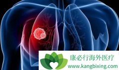 �������Ի���ͻ��ķΰ������Ʒ�������Щ