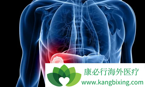 HCV