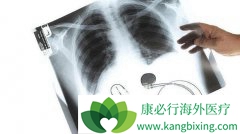 �ΰ���ת�Ʒ����ǻ����������ڷ�Сϸ���ΰ�����ѡ����