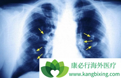 �ΰ����ڵ�֢״��Ҫ����Ϊ����˻��