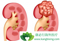 ����Щ�Ƚϳ�������������֢״