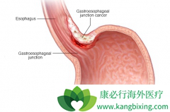 �������������Ű�֢״����Щ