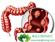 ���ڴ󳦰�֢״�����������ڳ�θ��������