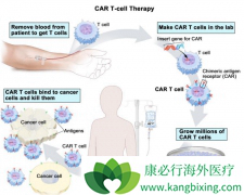 ���������İ�������CAR-T�е�ѡ������˾޴��Ӱ��