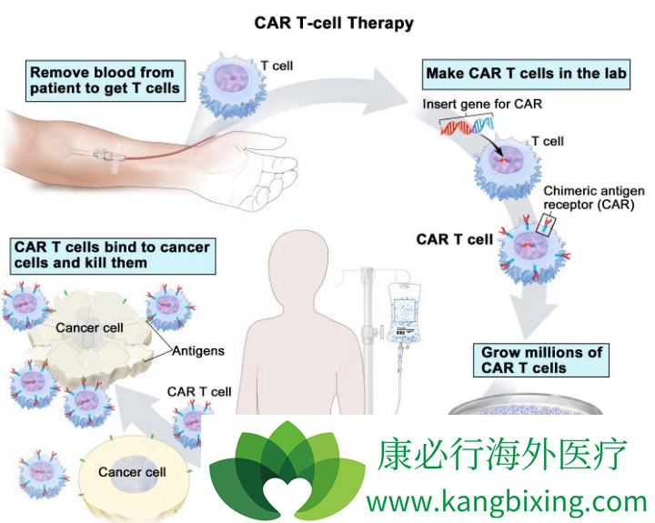 CAR-T