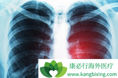 �ΰ���õ����Ʒ�������ݲ��鷢չ�����ı�