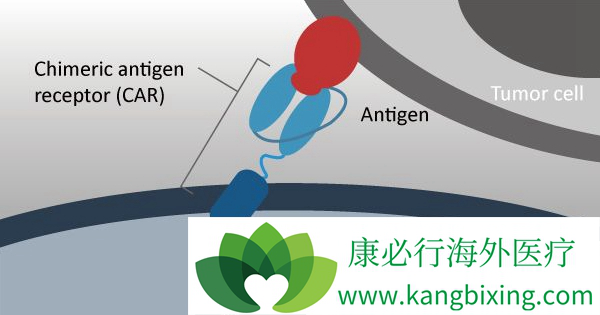 CAR-T