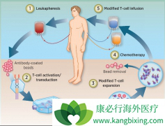 CAR-T���ʵ���������Ƶ���Ҫ��ս�кܶ�