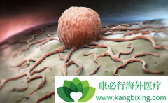 ��ͥ��֢Ԥ������������Щ��Ҫע���?