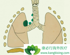 һ�����ж�����ΰ�����Ϊ�ΰ��ᴫȾ��?