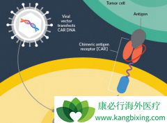 CAR-Tϸ�������ṩ��һ�����͵����������ֶ�