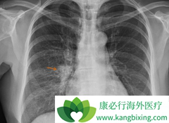 �������ϰ������ƶԷ�Сϸ���ΰ���ת��������Ч��