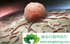 �����˸�����ת�Ƶİ�֢֢״����Щ?