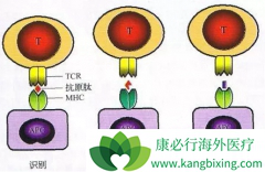 ���ڵ�CAR-T��������ɹ����л��к�Զ��·