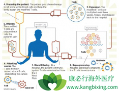 ŵ��CAR-Tϸ�����Ʒ���KYMRIAH��������������Ч����ģʽ