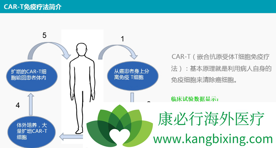 CAR-T