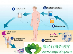 ��ͳ��CAR-T�Ʒ���һ�������ض����߼��ض����Ͱ�ϸ���ķ���