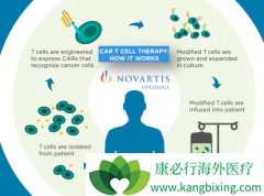 CAR-Tϸ���Ʒ�KYMRIAHΪ�����Ի�������DLBCL�ṩ����Ӧ��