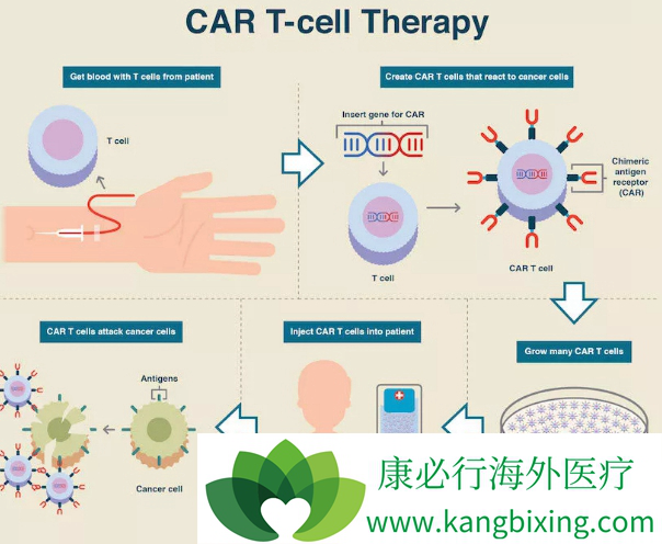 CAR-T