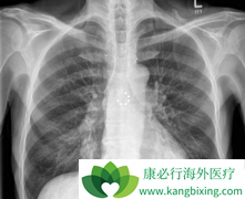 Сϸ���ΰ���������N3�ܰͽ�����������ھ���