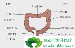 ֱ����֢״���׷����������ֱ����֢Ԥ��