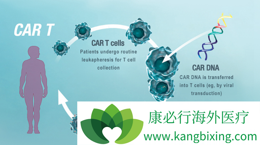 CAR-T