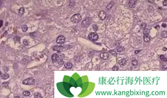 �ΰ�������ǰ֢״��඼�����ž��ҵ���ʹ