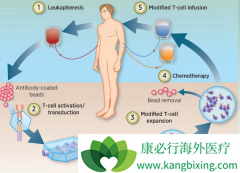 CAR-Tϸ���Ʒ������߶ȸ��Ի���Tϸ����޶����