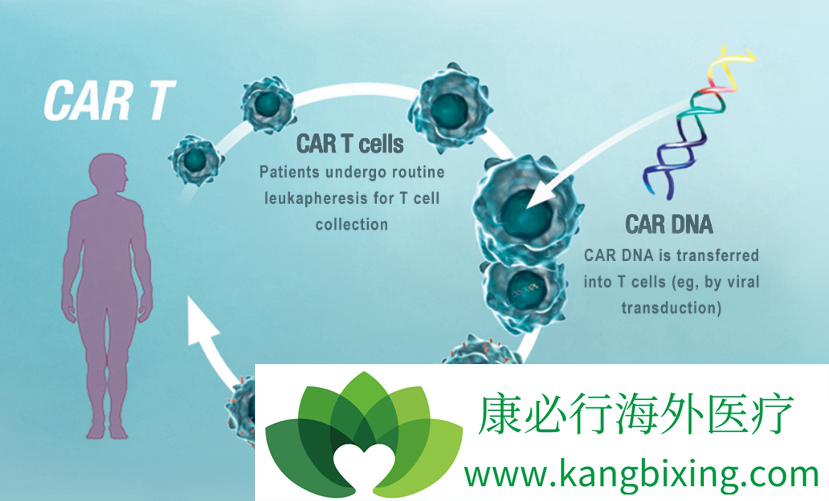 CAR-T