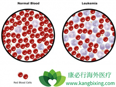 �����ܰ�ϸ����Ѫ������ʹ��CAR-Tϸ�����Ʒ�����