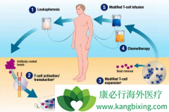 CAR-Tϸ�������������͵�ϸ�������Ʒ�