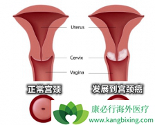 ���ڹ�����֢״�����״��쳣��