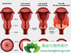 �˽����ڹ�����֢״��������ǰԤ��������