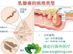 �������ٰ�֢״������Ƥ���ı������֢״