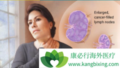 �����ܰ���֢״���ð��֢�ȼ�������