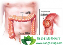 ��Ѫ�����������ֱ����֢״