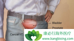 ��Ƶ���Ƿǳ�������ǰ���ٰ�֢״