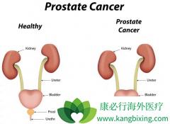 ���������Ƿǳ����͵�����ǰ���ٰ�֢״